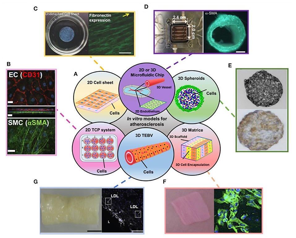 Frontiers  Recent Progress in in vitro Models for Atherosclerosis Studies