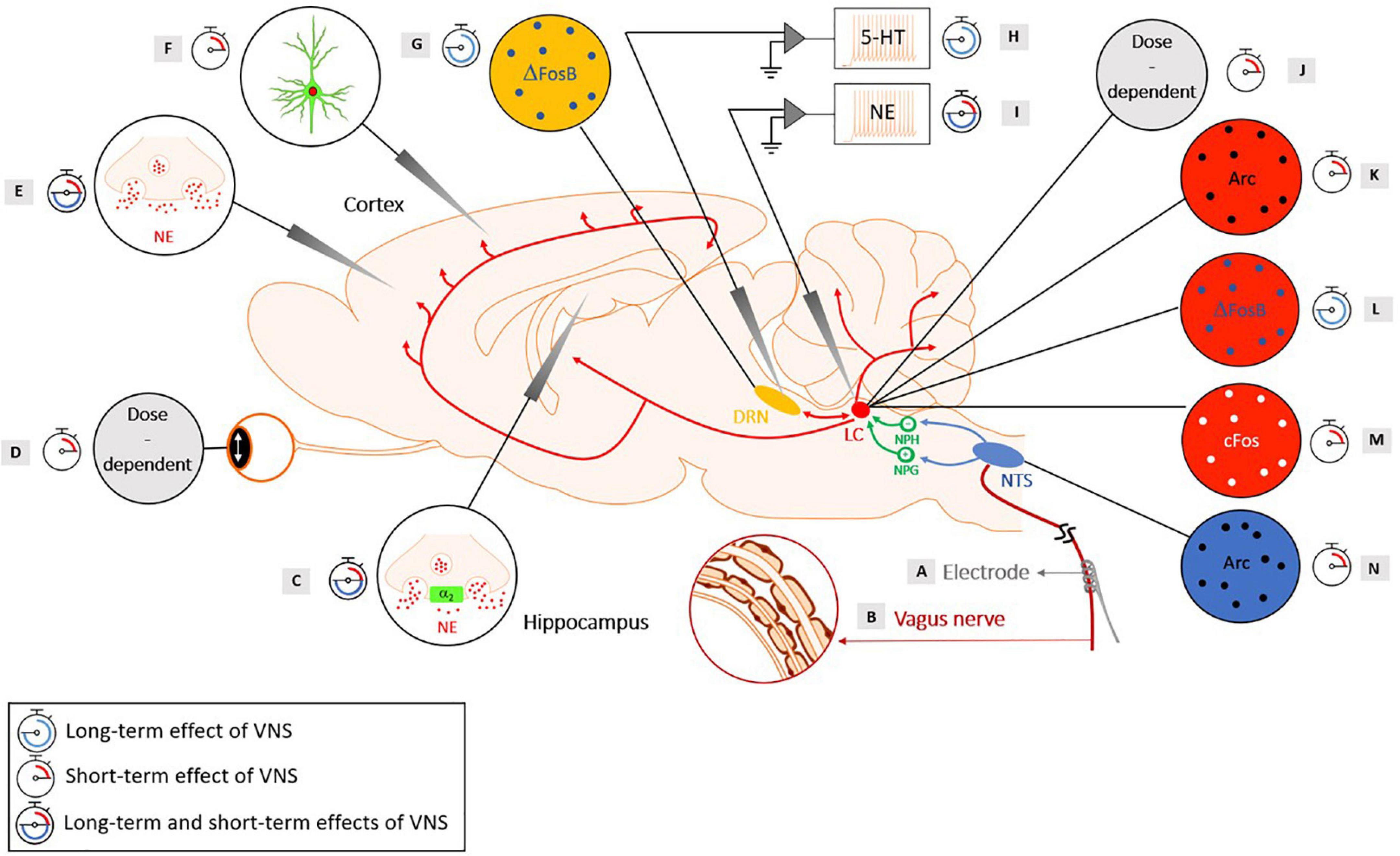 Neurology : Vagus nerve stimulation