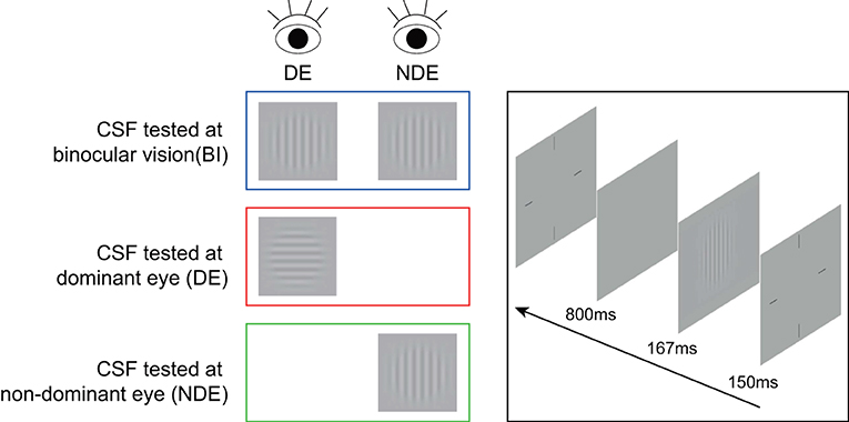 Intermittent binocular diplopia cheap
