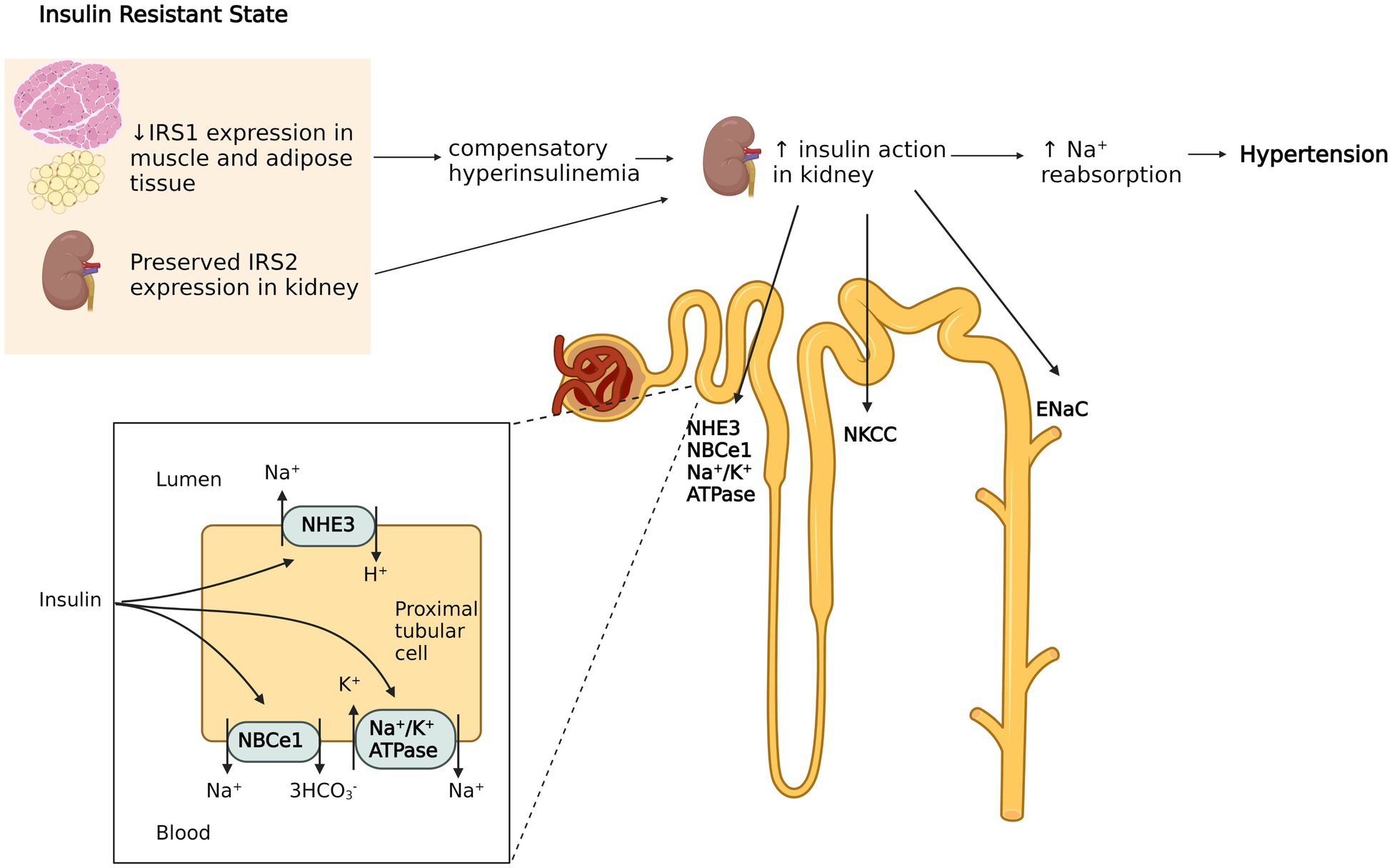 High Dietary Protein Exacerbates Hypertension and Renal Damage in Dahl SS  Rats by Increasing Infiltrating Immune Cells in the Kidney