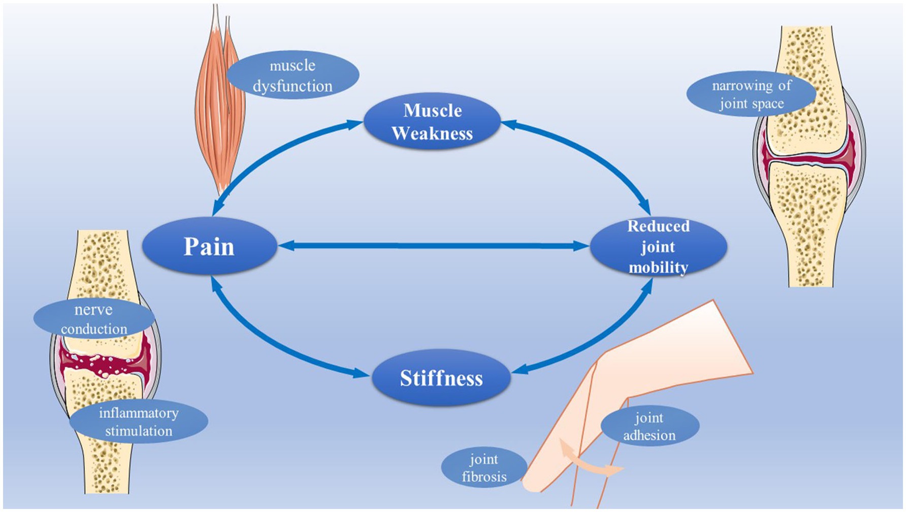 exercise for osteoarthritis a literature review of pathology and mechanism