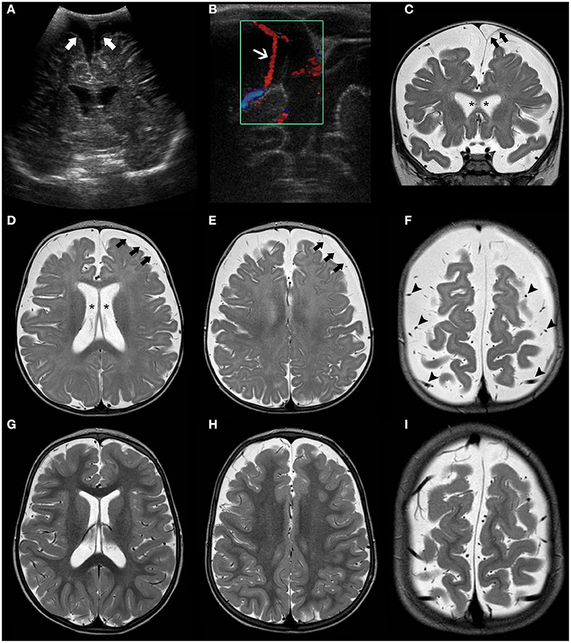 Teenager with right flank pain, Pediatric Radiology Case, Pediatric  Imaging