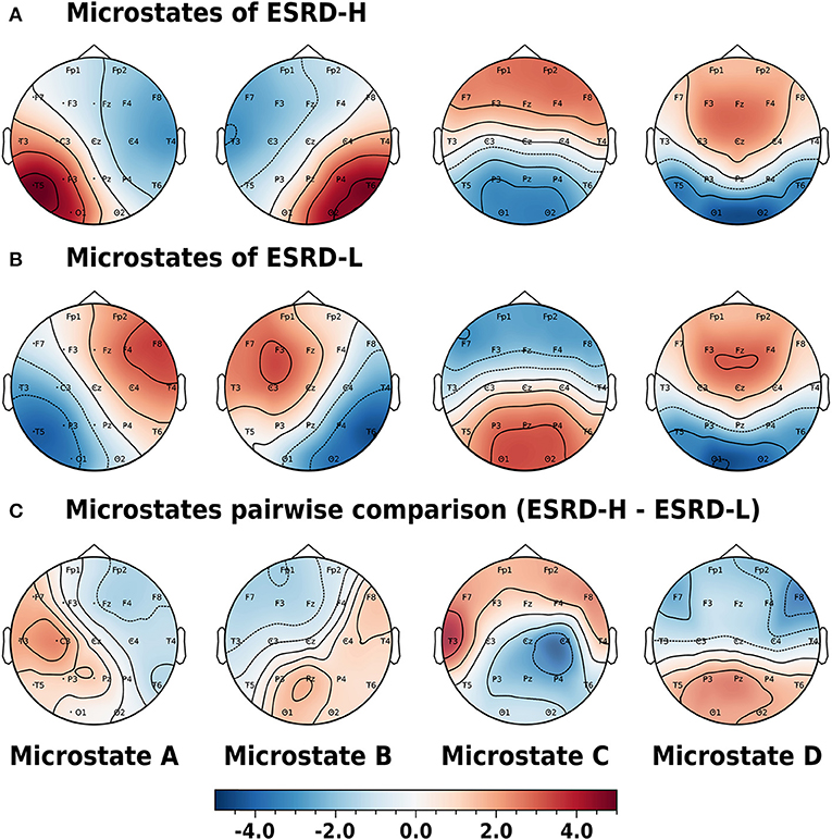 Frontiers  EEG Delta/Theta Ratio and Microstate Analysis