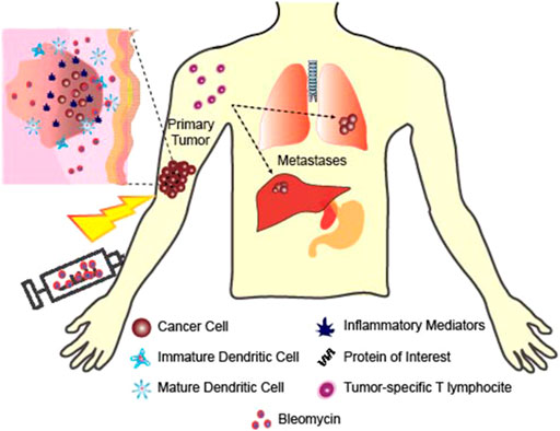 Example of transdermal electric muscle stimulation by means of a