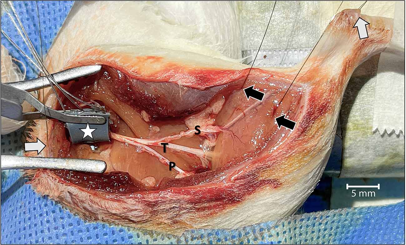 Left Lower Leg Crush Injury