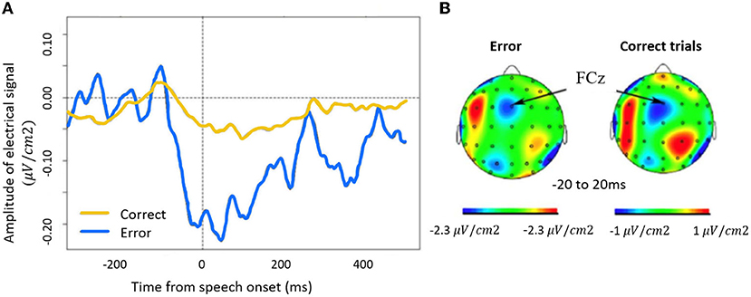 Figure 3 - (A) Patients with damage to the prefrontal cortex were given a picture-naming task in which the ERN was measured in correct and incorrect trials using EEG.