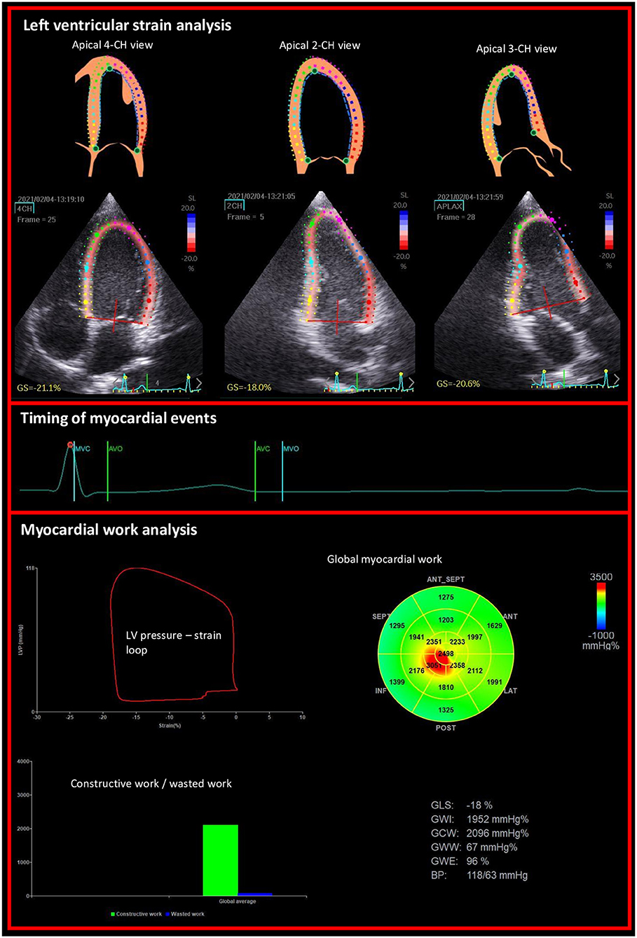 Frontiers  Left Ventricular Strains and Myocardial Work in