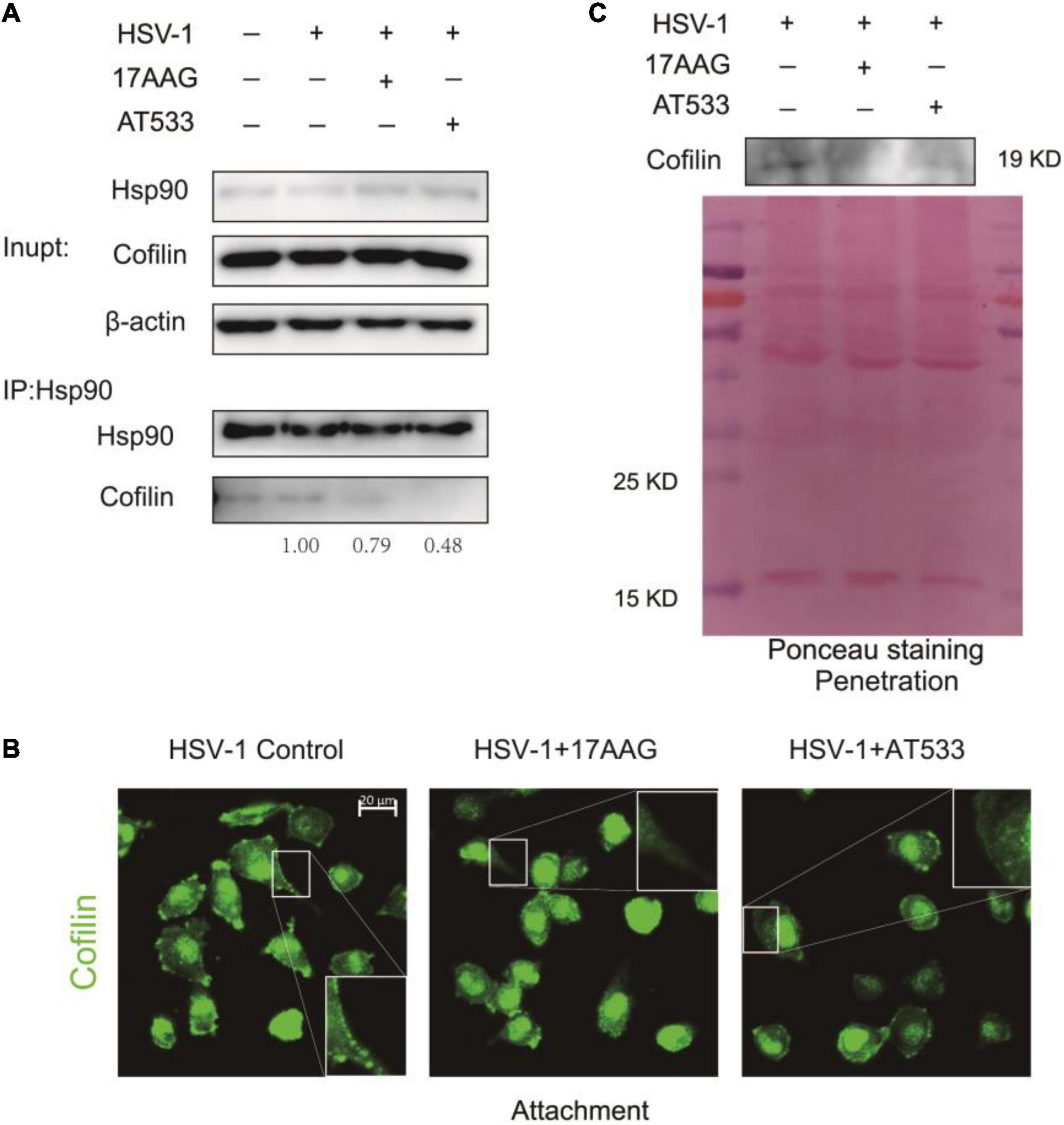 Herpes Simplex Virus-1 in the Brain: The Dark Side of a Sneaky Infection:  Trends in Microbiology