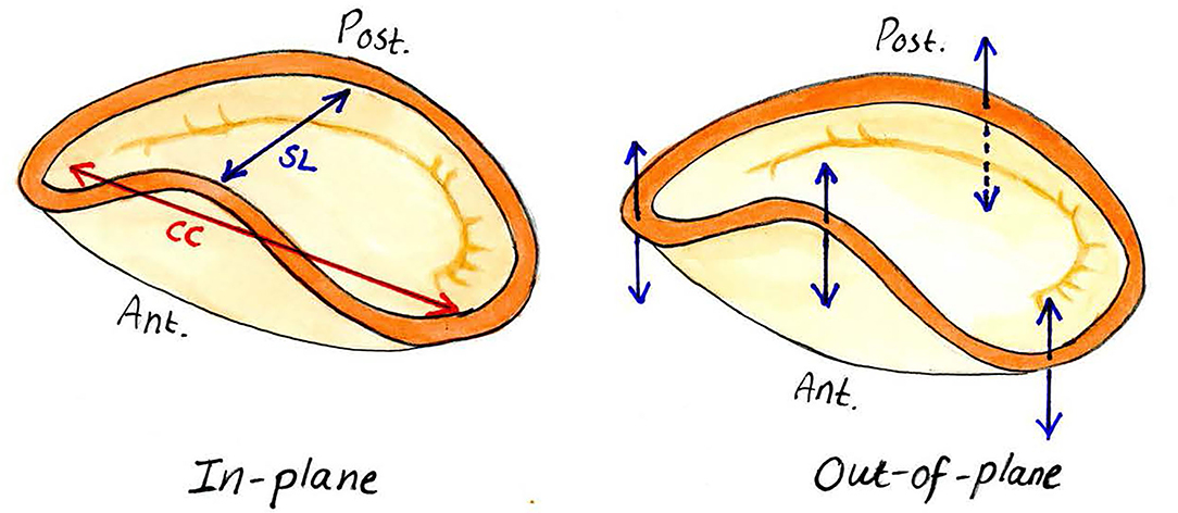 Frontiers | Mitral Annular and Their Potential Impact on Annuloplasty Ring Selection