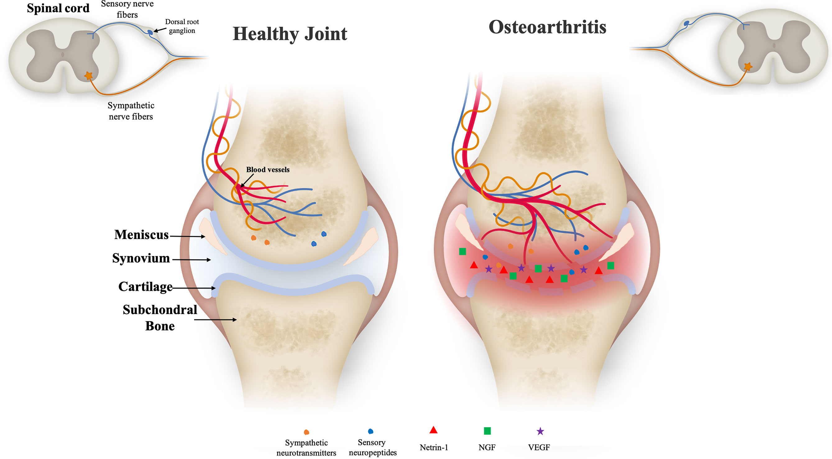 RICPIND KneeSoothe ThermalTherapy Brace