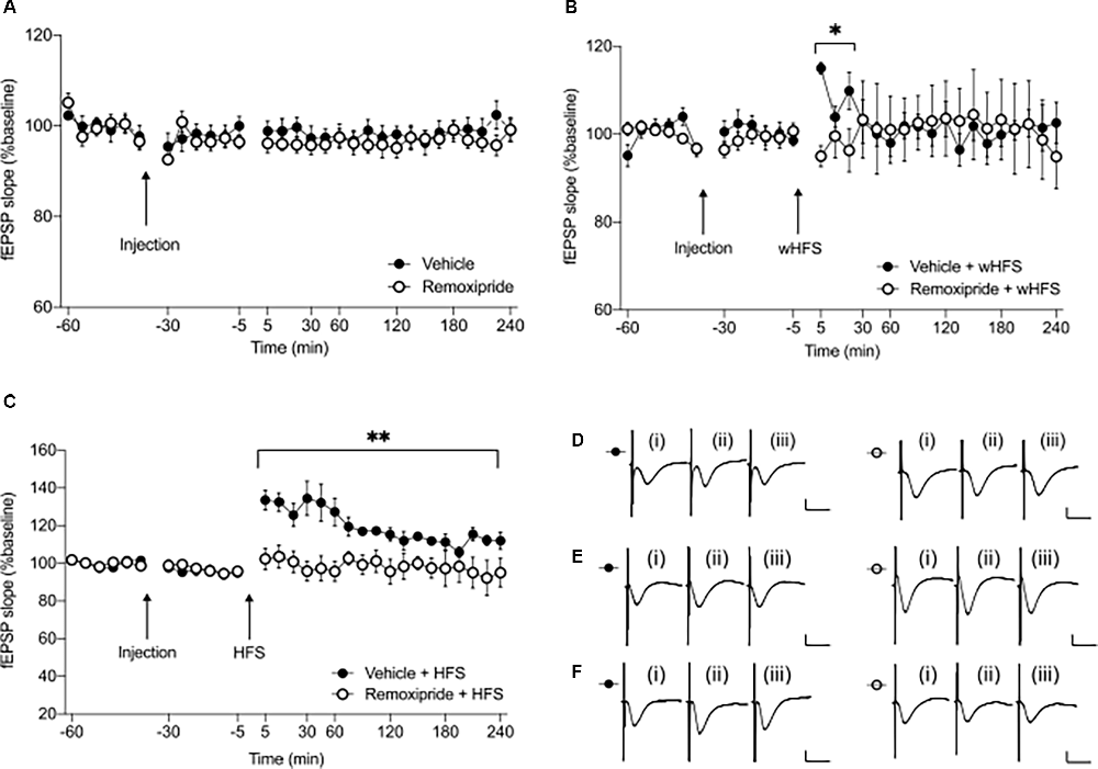 Synaptic Plasticity Learning and Memory in Perirhinal Cortex