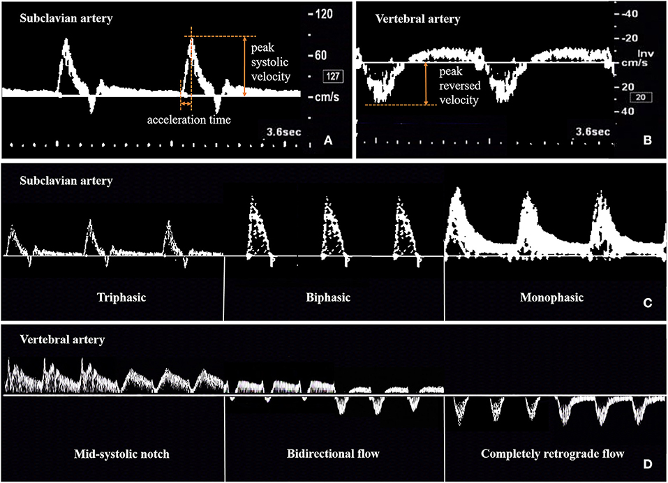 Frontiers Color Doppler Ultrasonography For The Evaluation Of