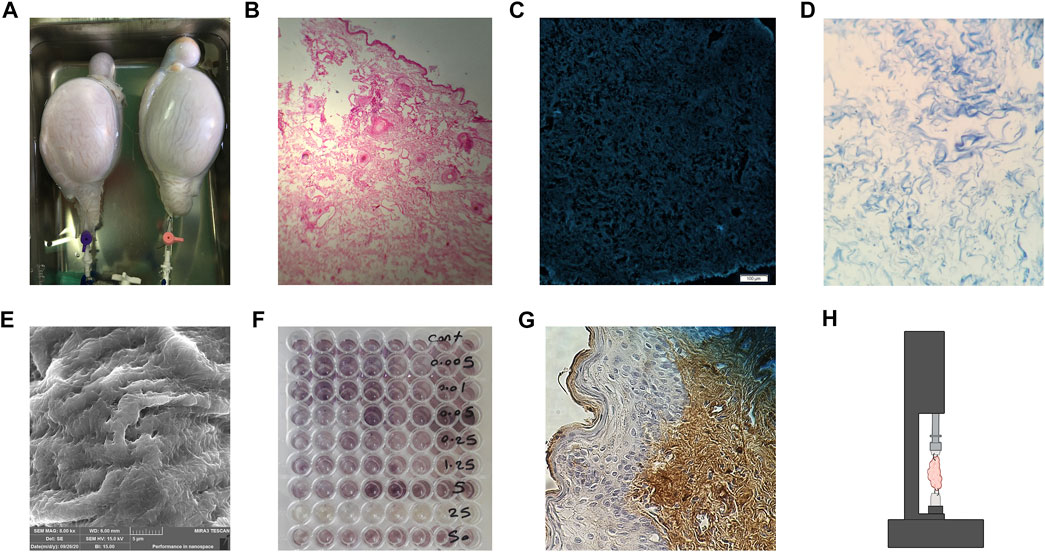 Frontiers  Using extracellular matrix as the bio-glue for wound repair in  the surgery