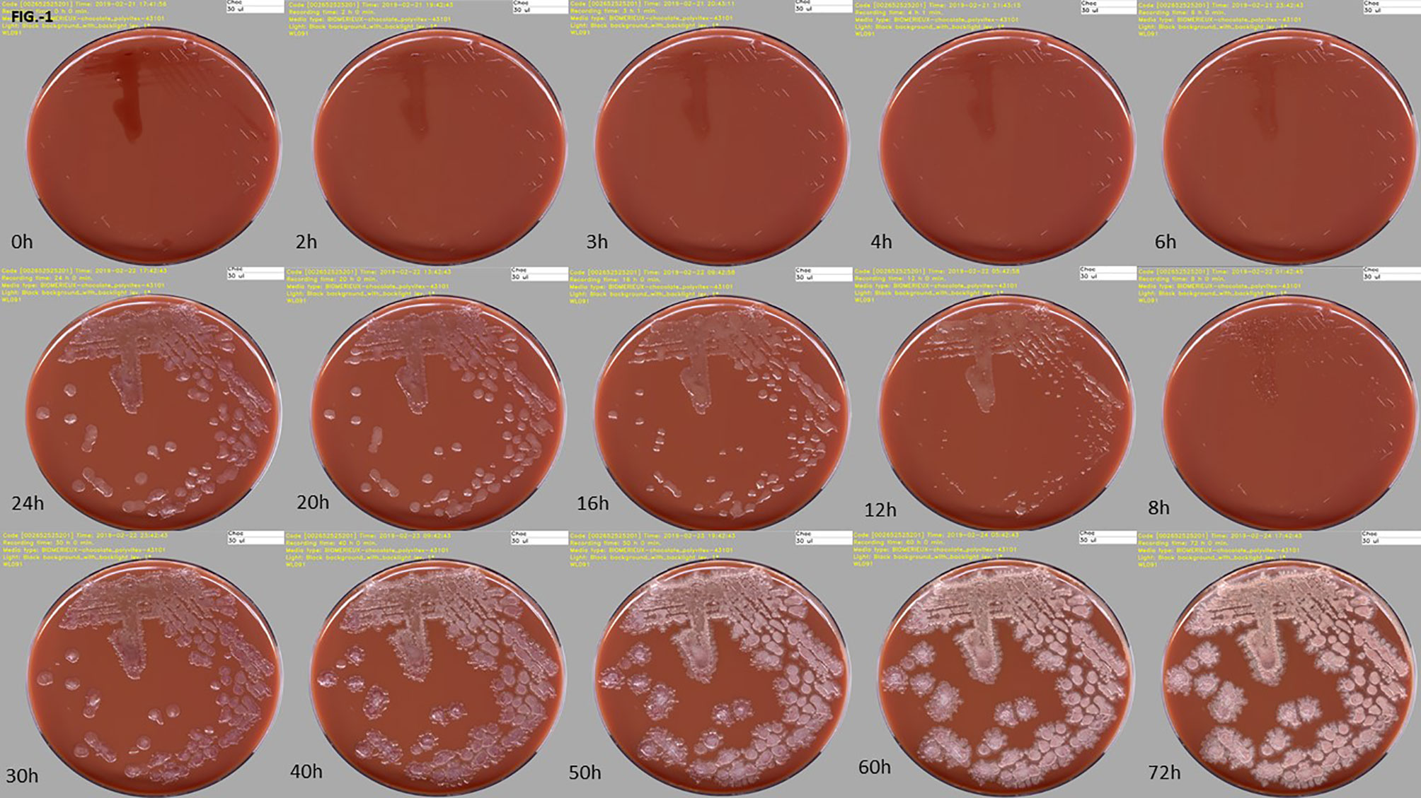 Urine sample results up to 8 Hours Faster bioMerieux