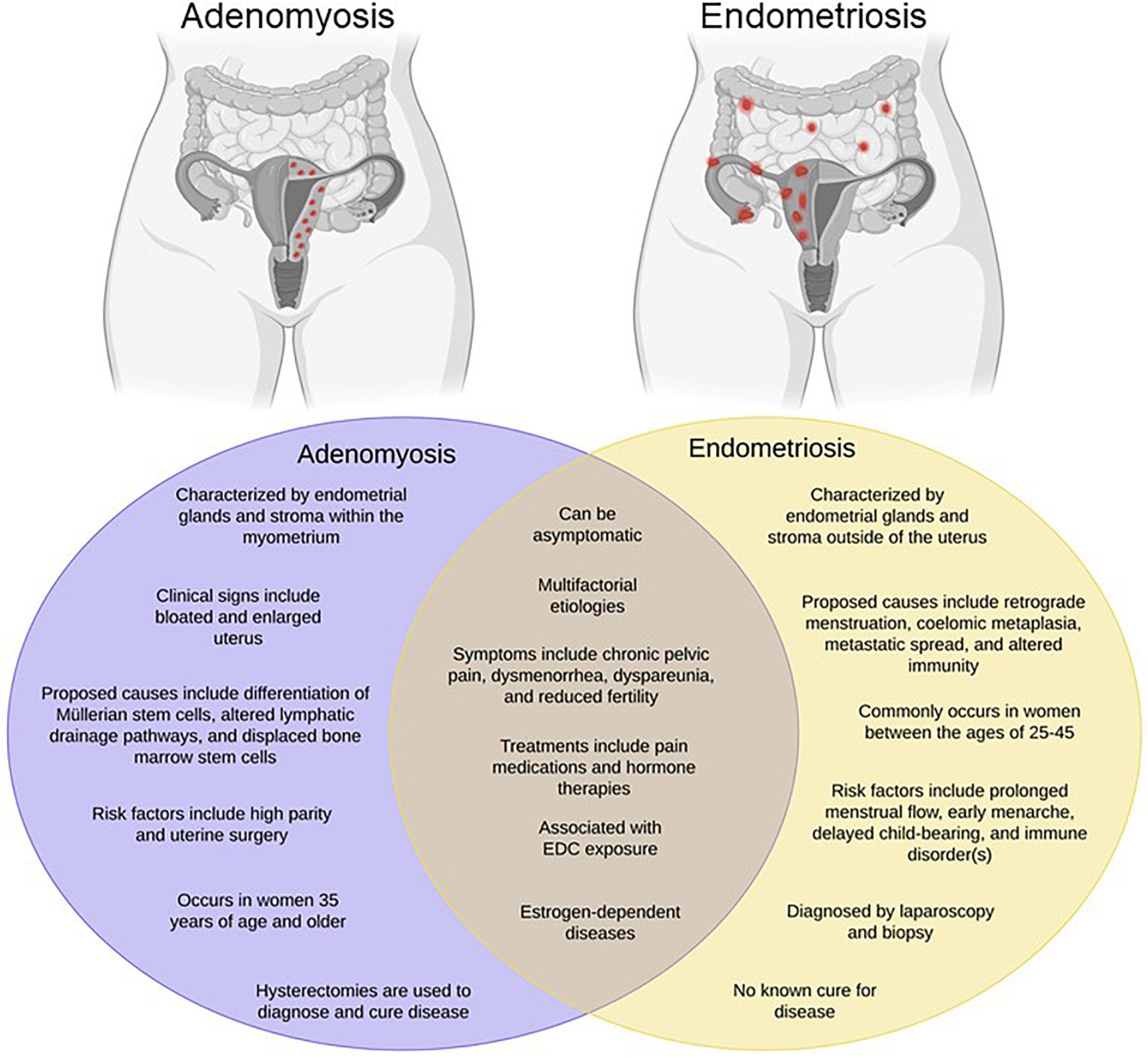 Endometriosis Chart