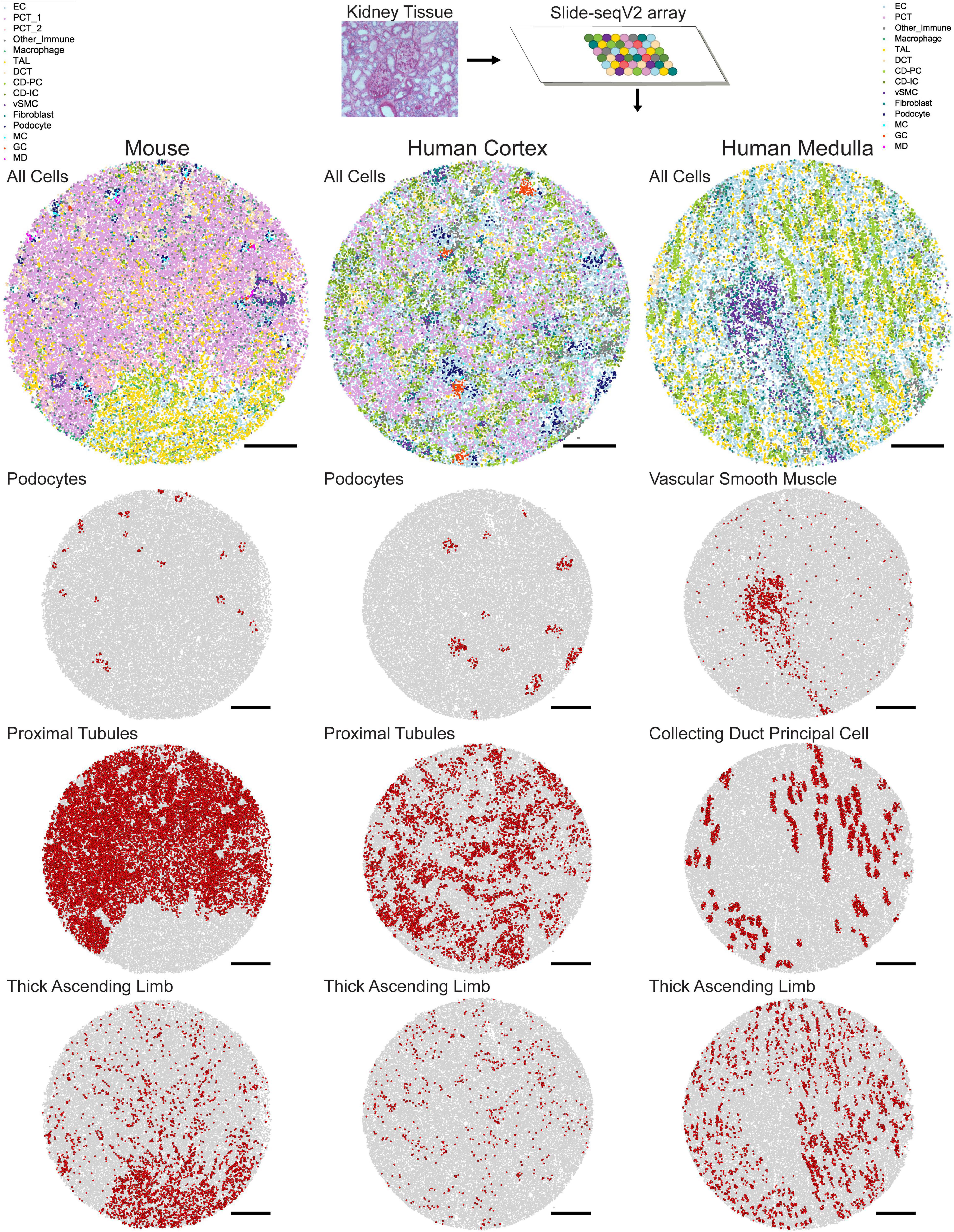 Spatially resolved transcriptomics: advances and applications