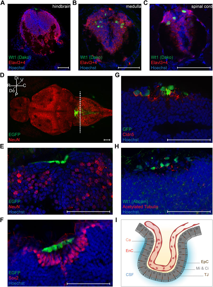 Frontiers | The Wilms Tumor Gene wt1a Contributes to Blood