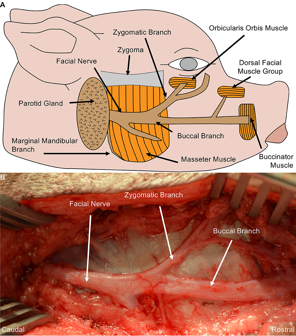 Anatomy and clinical applications of the mandibular nerve.