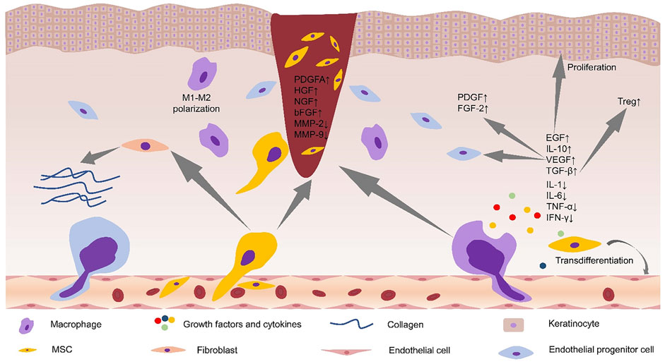 Experimental Stem Cell Therapy Speeds Up Wound Healing in Diabetes