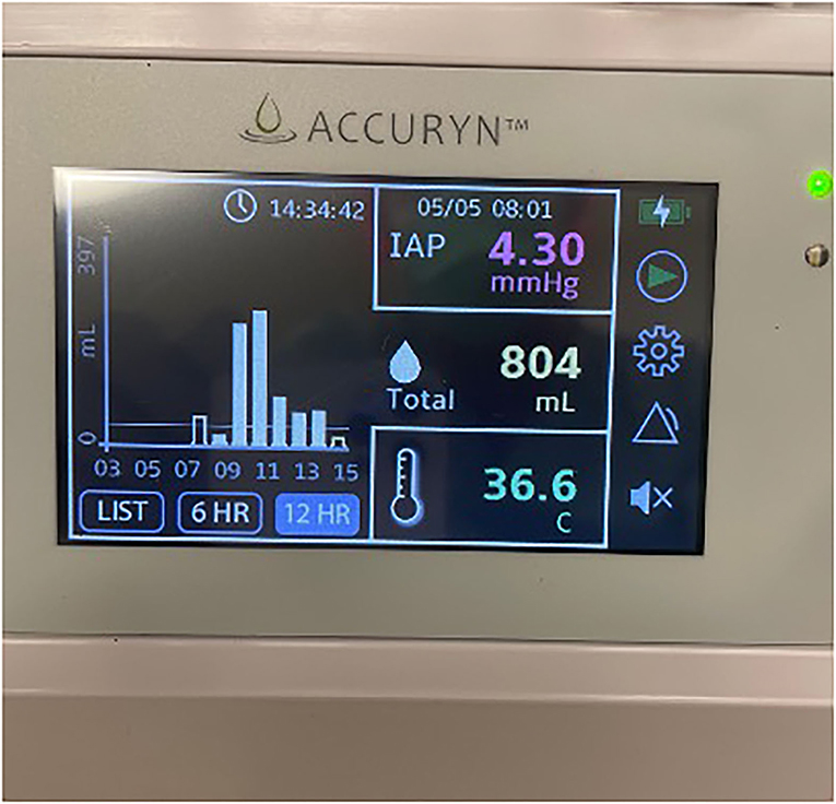 Cardiology Outpatients 24 Hour Blood Pressure Monitor - Milton