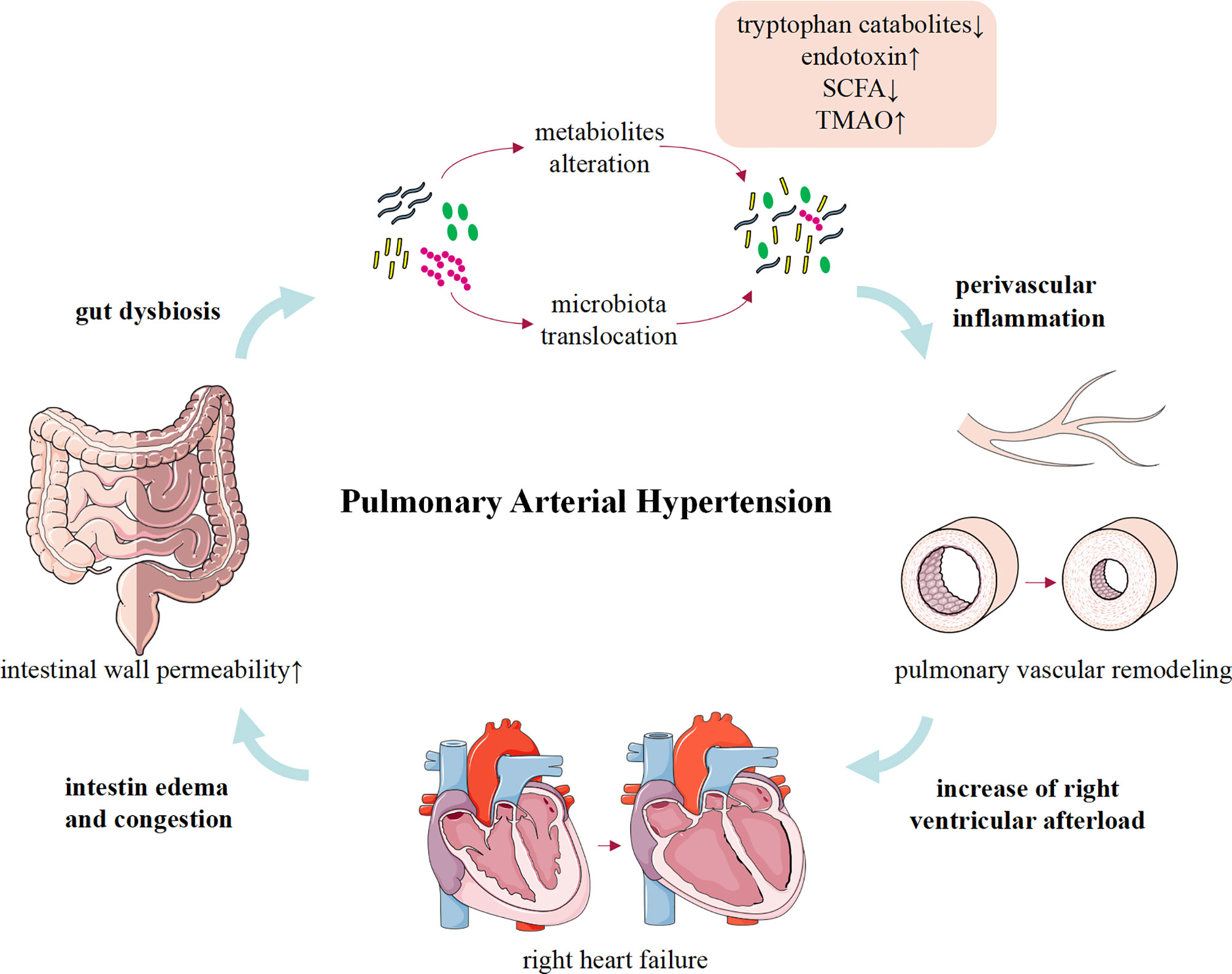 pulmonary artery hypertension