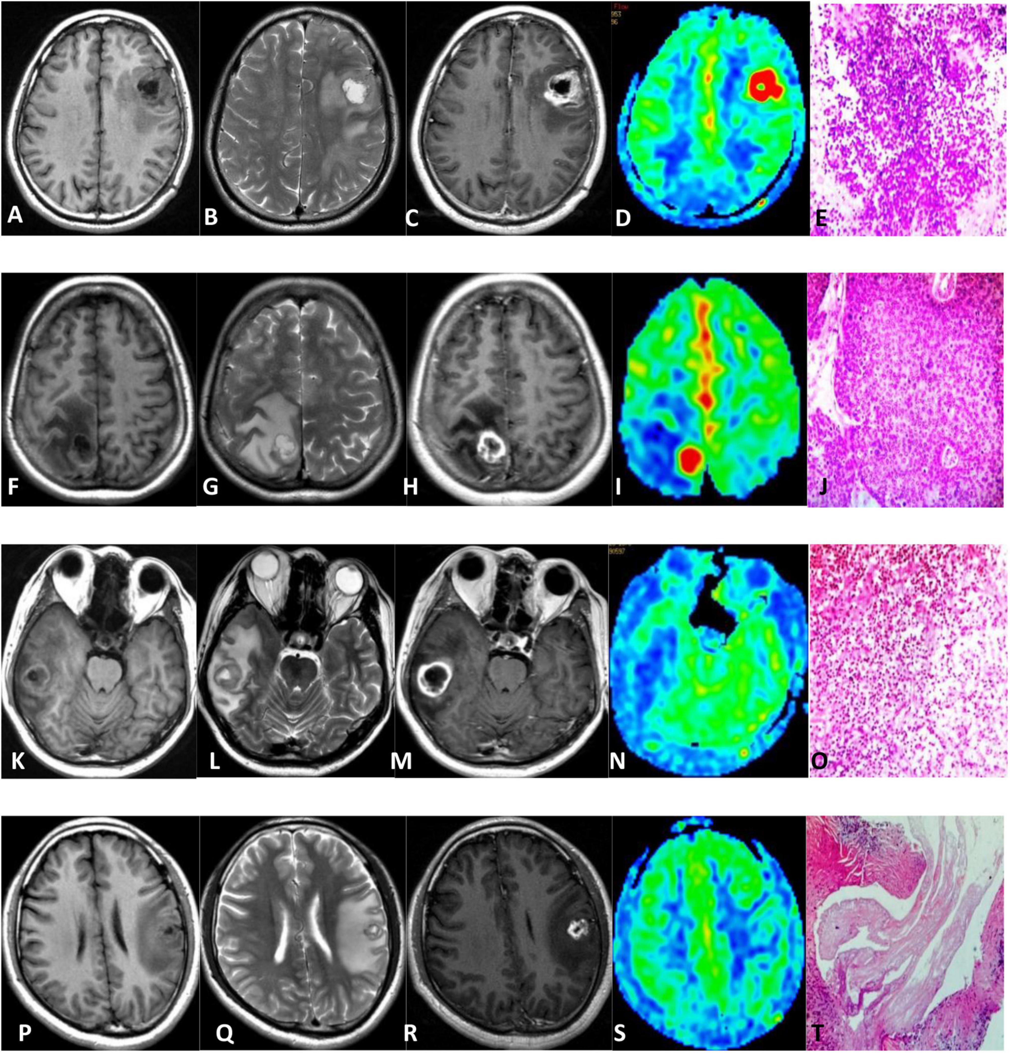 The test database of MR brain images and corresponding results for the