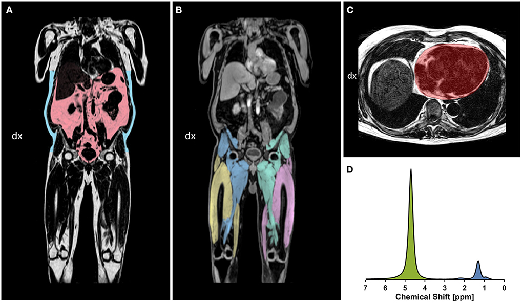 The contrast medium can be very well seen in even small visceral