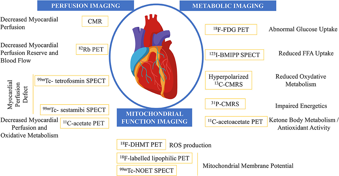 Left Ventricular Strain from Myocardial Perfusion PET Imaging: Method  Development and Comparison to 2-Dimensional Echocardiography