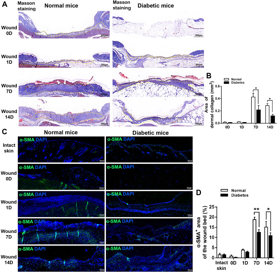 Frontiers  Exploring the contribution of pro-inflammatory cytokines to  impaired wound healing in diabetes