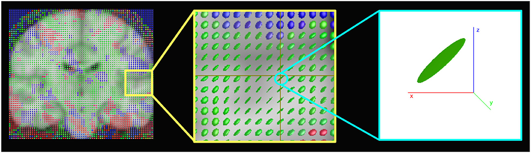 O misterioso caso do desaparecimento do Anisotropic Filtering na