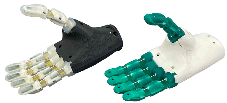 SmartHand prosthesis (left) and myoelectric hook (right) normally used