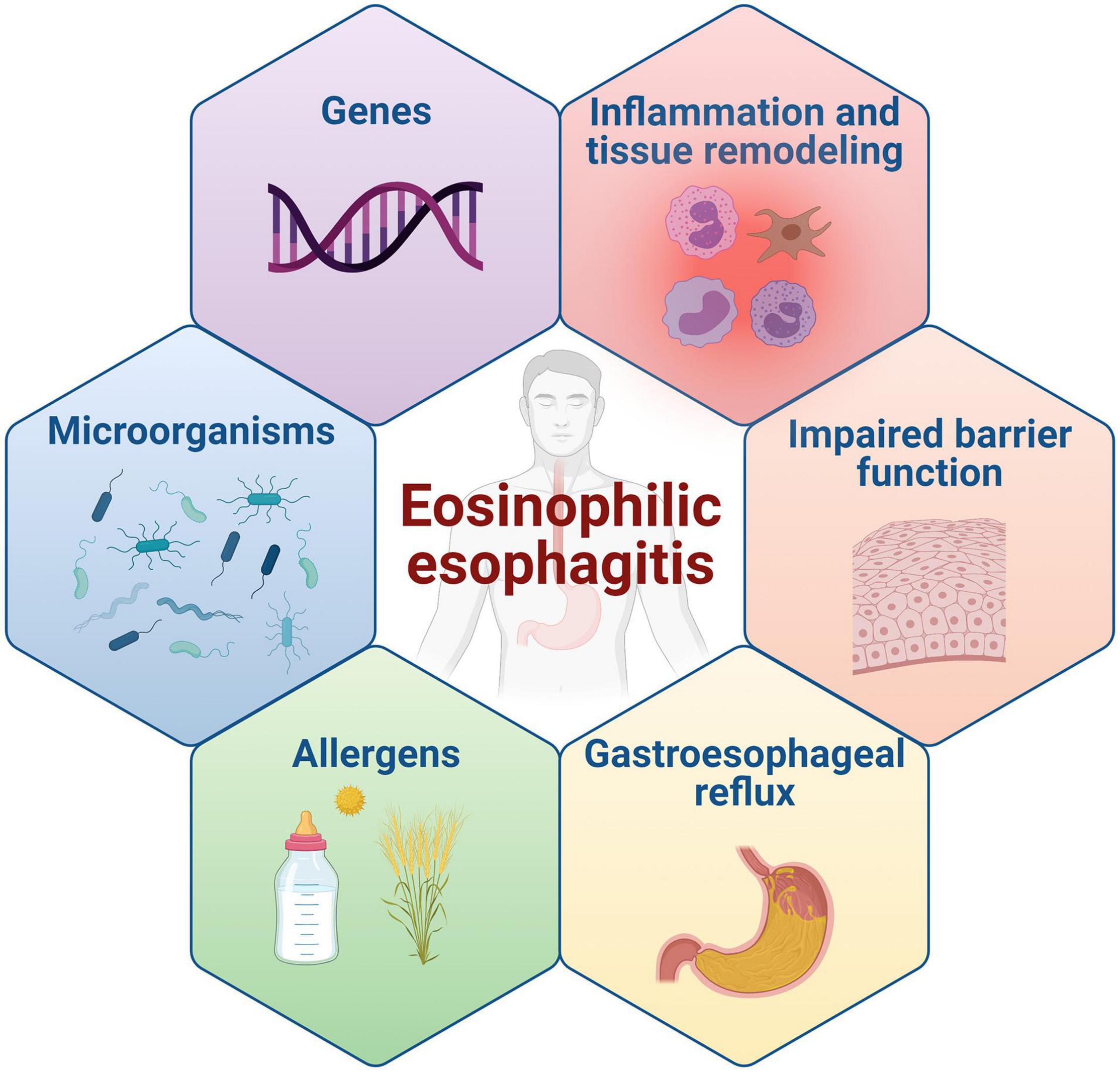 Eosinophilic Esophagitis Pathogenesis