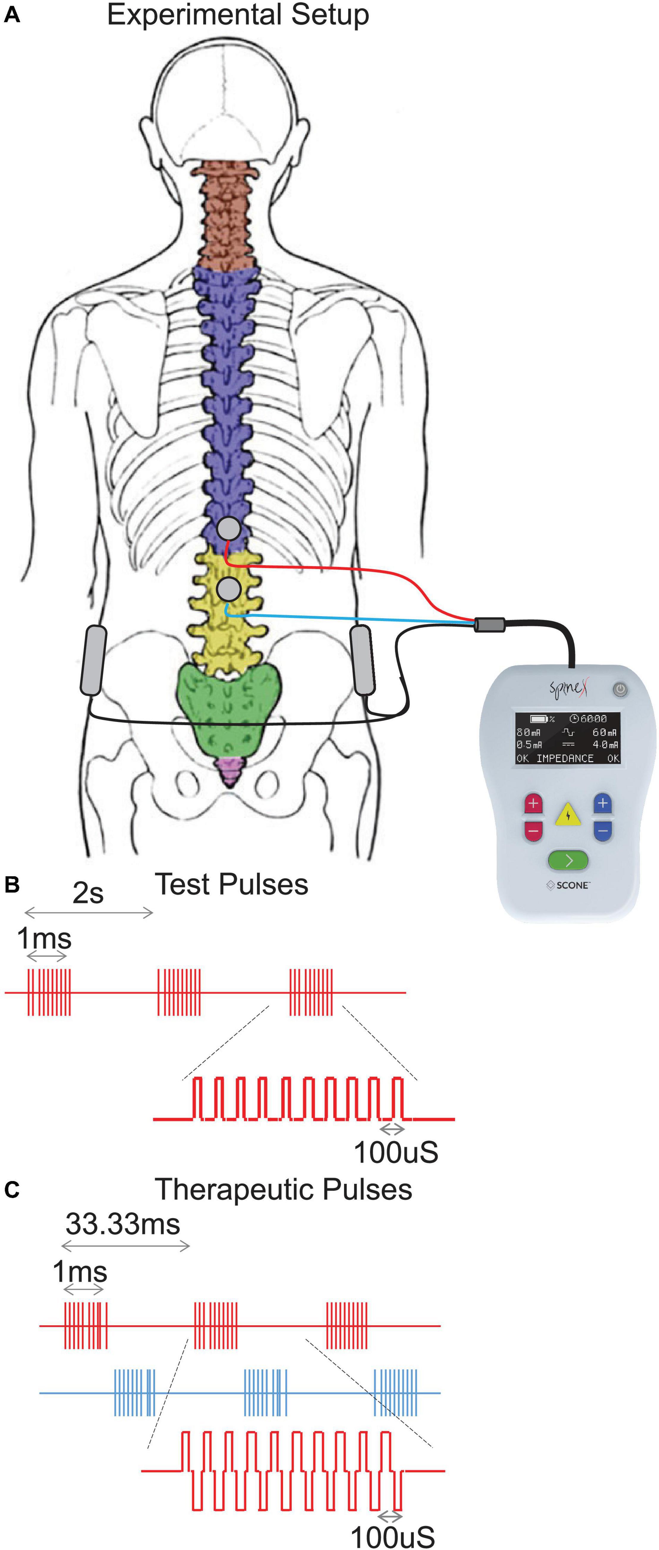 Electrical Stimulation For The Pelvic Floor - Incontinence & Prolapse