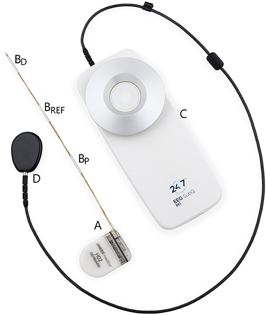 Frontiers  Expert Perspective: Who May Benefit Most From the New Ultra  Long-Term Subcutaneous EEG Monitoring?