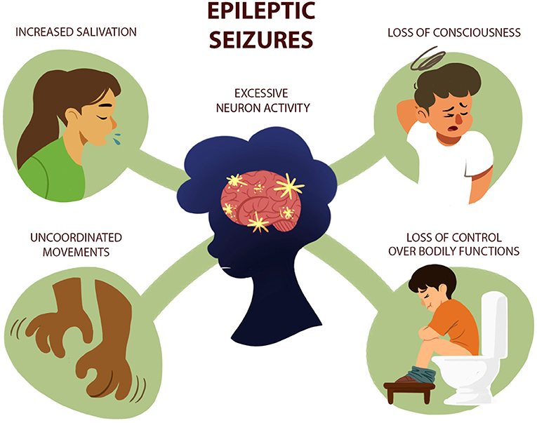 Figure 1 - Epileptic seizures are caused by excessive and simultaneous neuron activity in the brain—like everyone talking at once in a classroom.