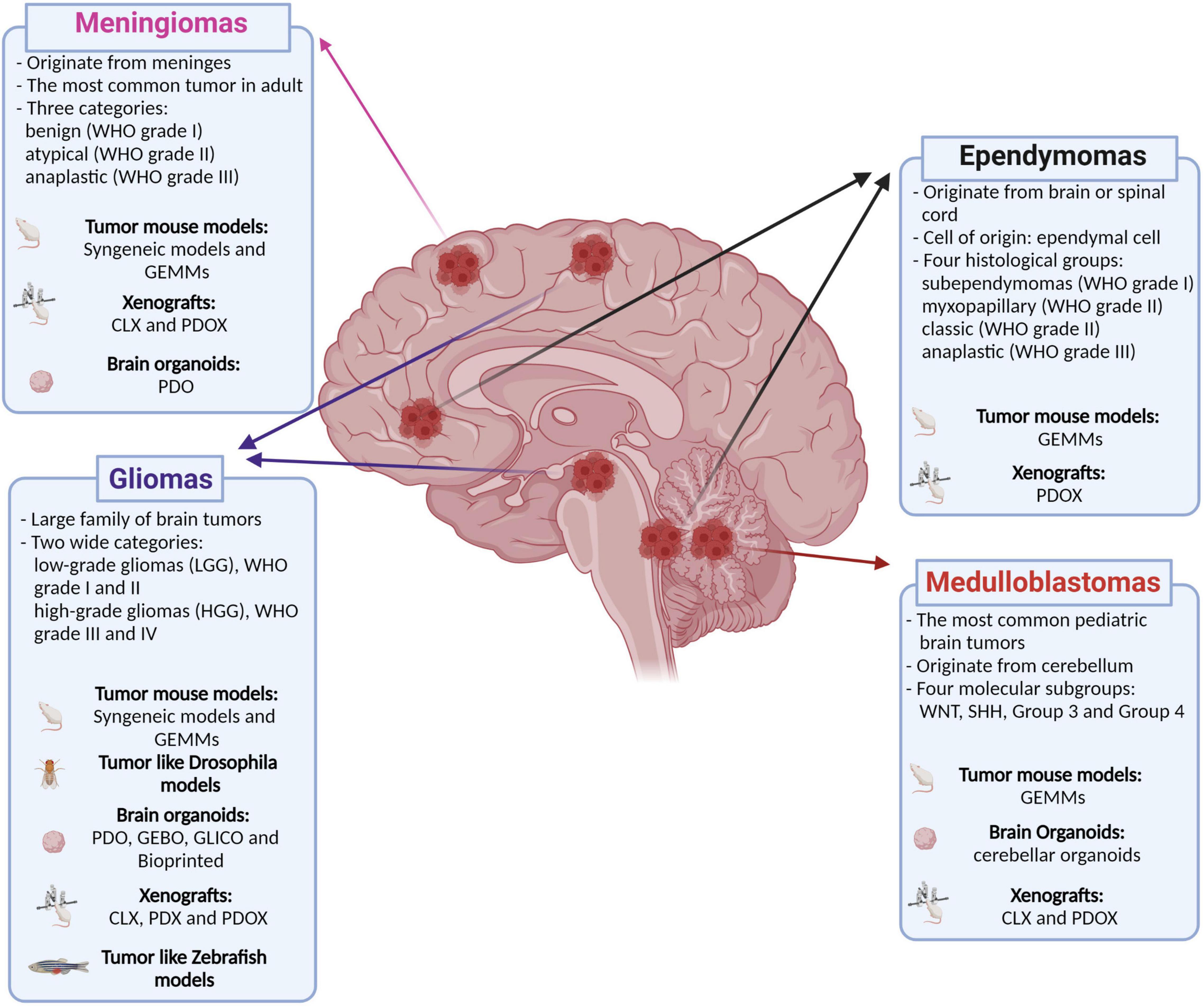 brain cancer cell