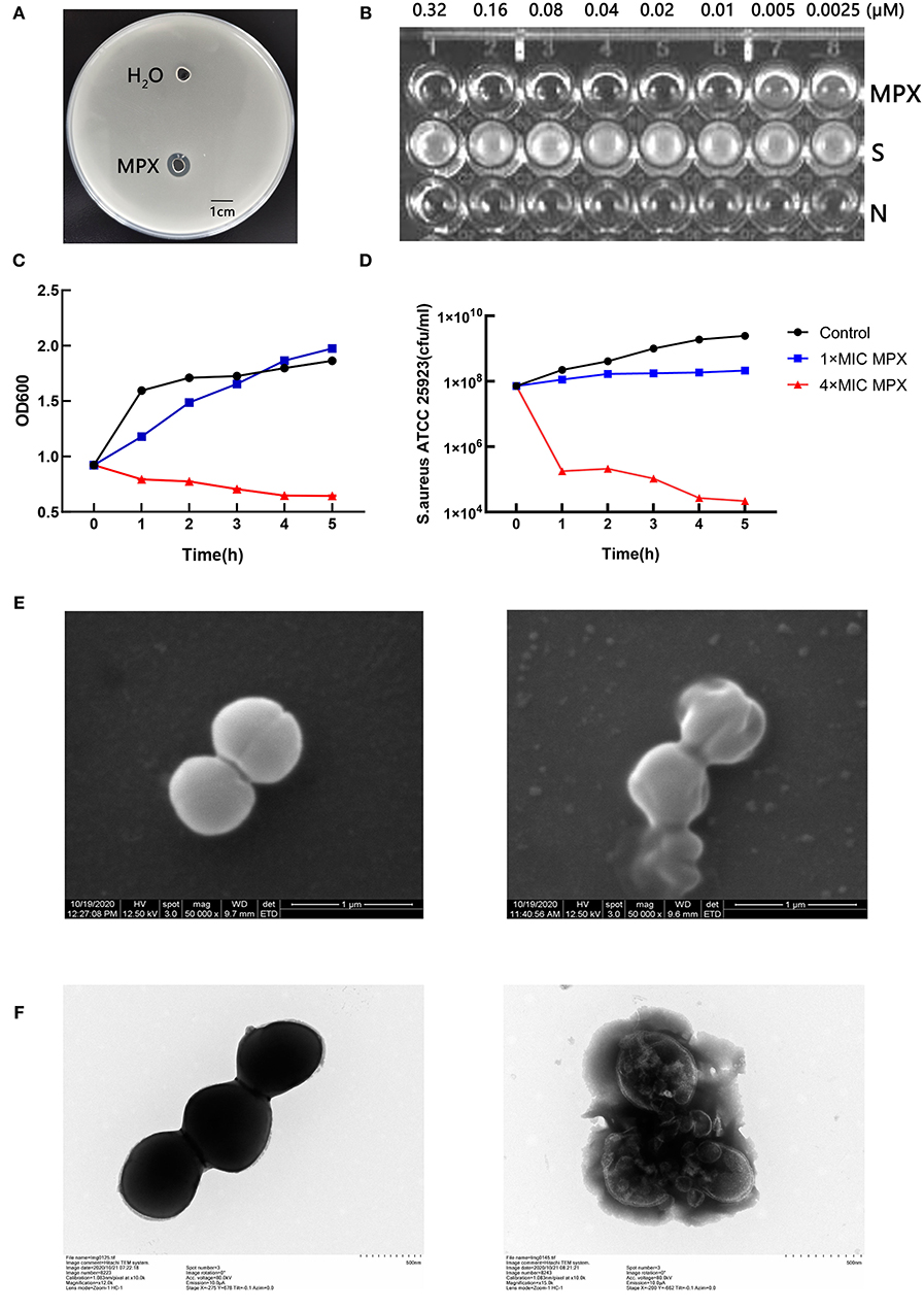 Staphylococcus aureus morphology visualised using Gram staining (10×