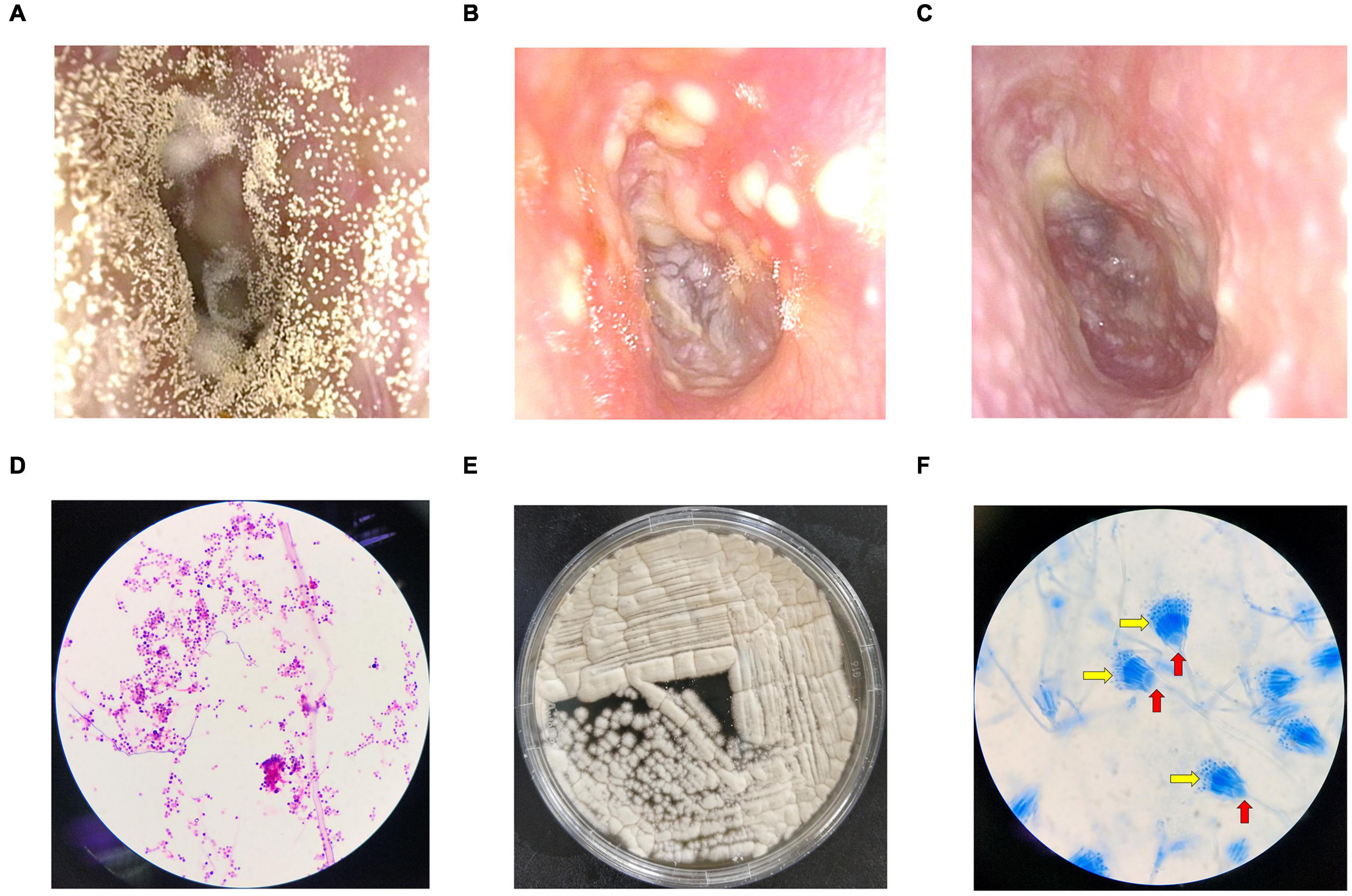 Tinea unguium: etiology, clinical manifestation, diagnosis and treatment -  Online Biology Notes