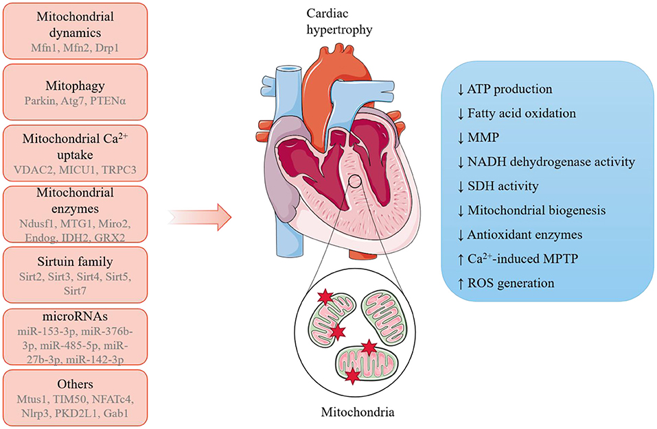 hypertrophy of the heart