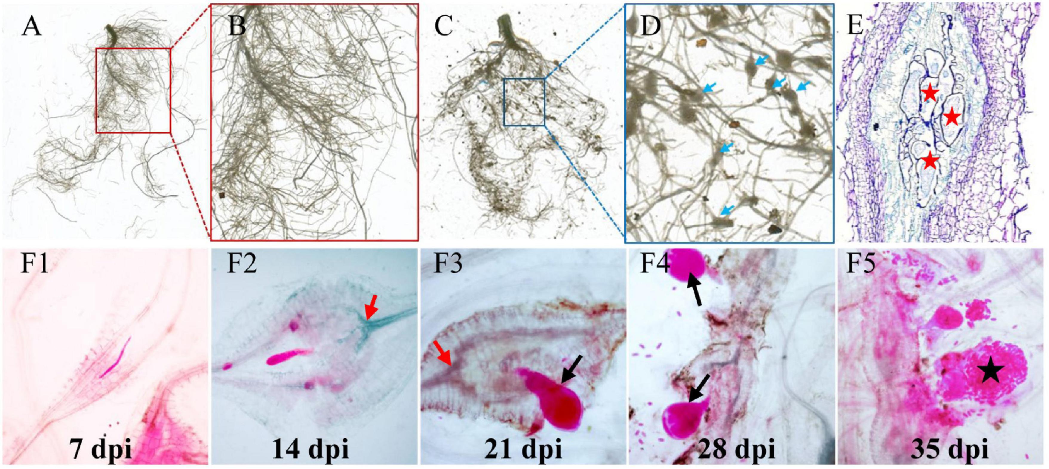 Frontiers  Belowground Chemical Interactions: An Insight Into  Host-Specific Behavior of Globodera spp. Hatched in Root Exudates From  Potato and Its Wild Relative, Solanum sisymbriifolium