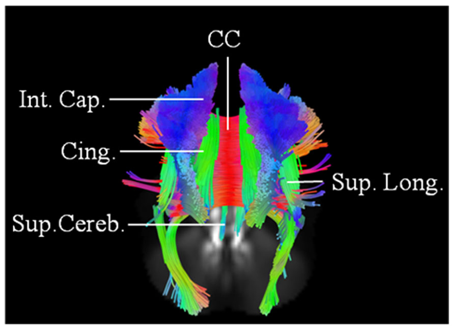 Image result for connectometry