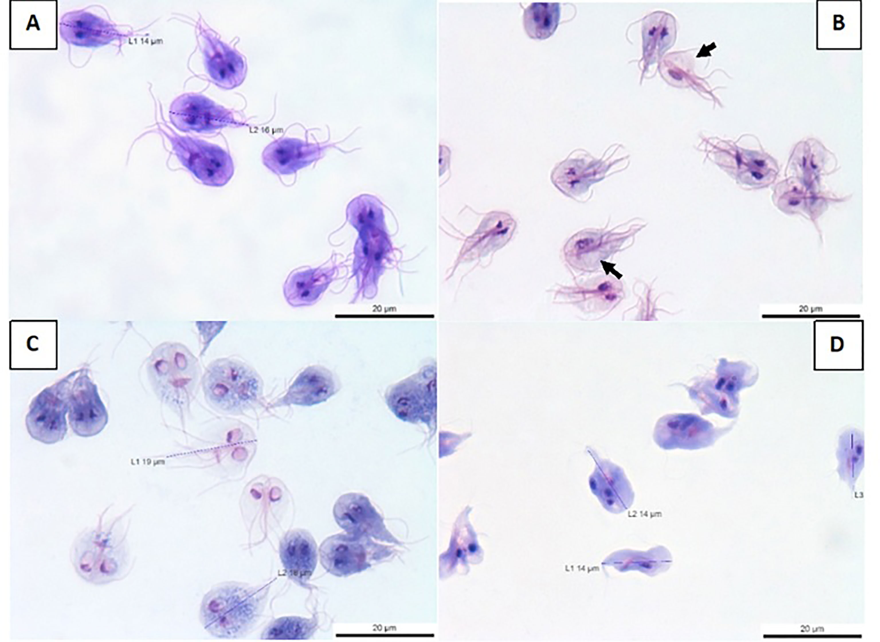 giardia forum