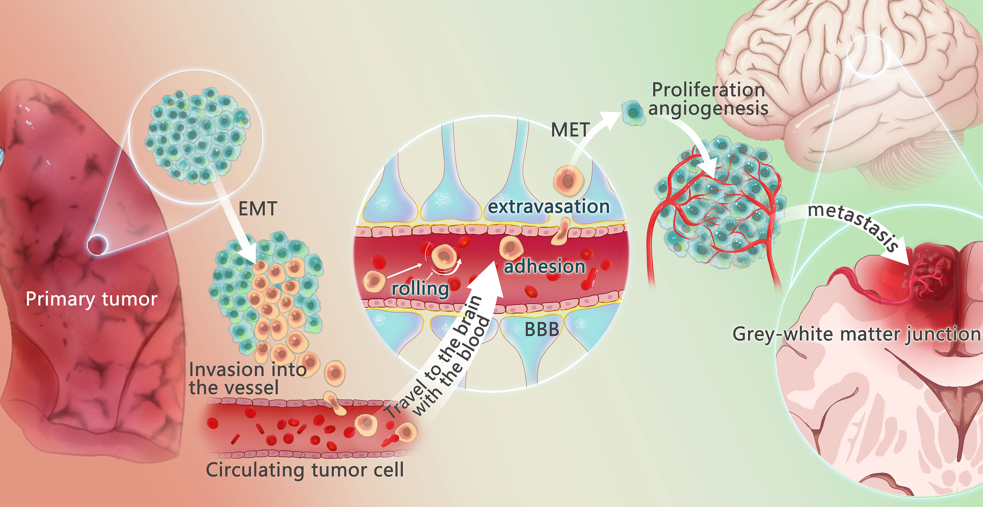 Frontiers Tumor Immune Microenvironment And Immunotherapy In Brain