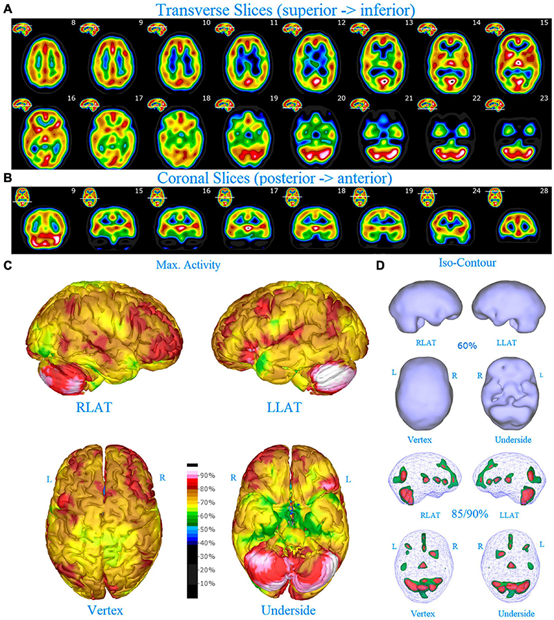 BRAIN TEST NÍVEL 177 EM PORTUGUÊS