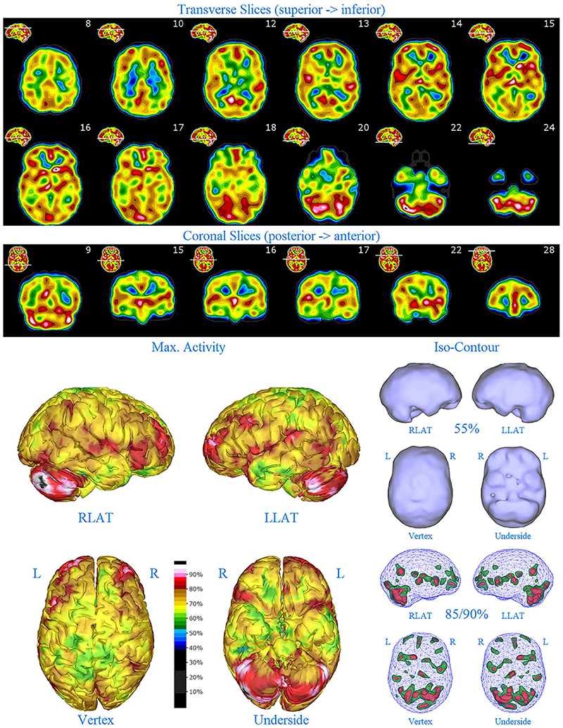 Brain and Behavior: Vol 13, No 9