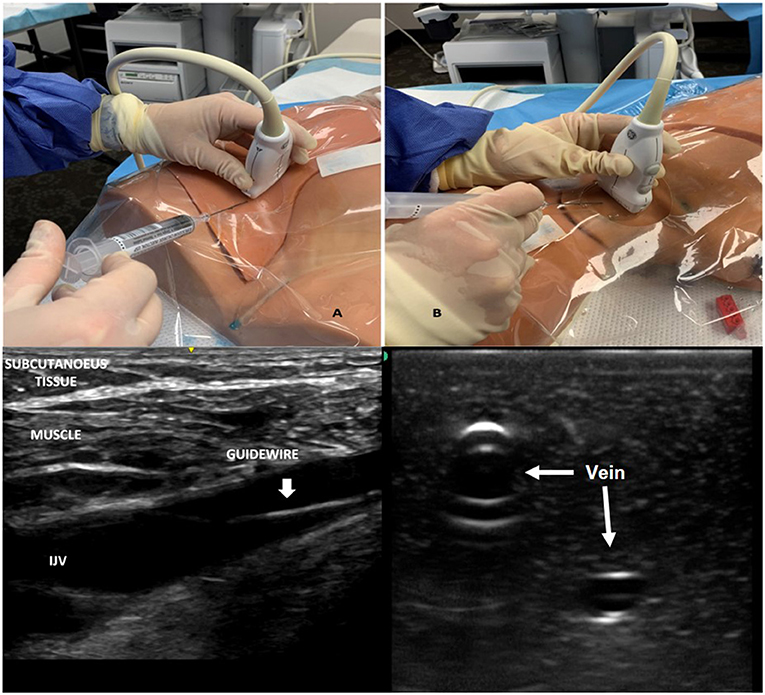 Frontiers  Point-of-Care Ultrasound in the Pediatric Intensive
