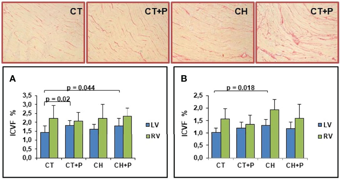 Frontiers | Air Pollution's Impact on Cardiac Remodeling in an