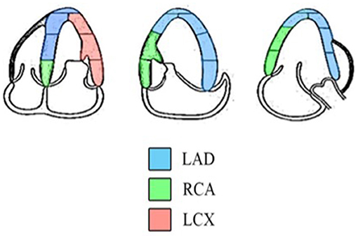 Strain Echocardiography in Acute Cardiovascular Diseases - The