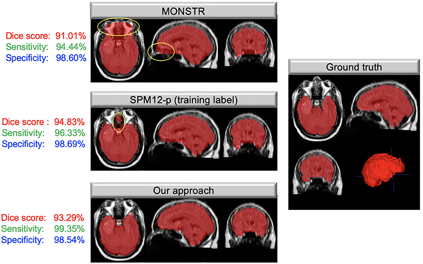 Frontiers  Automated Skull Stripping in Mouse Functional Magnetic  Resonance Imaging Analysis Using 3D U-Net