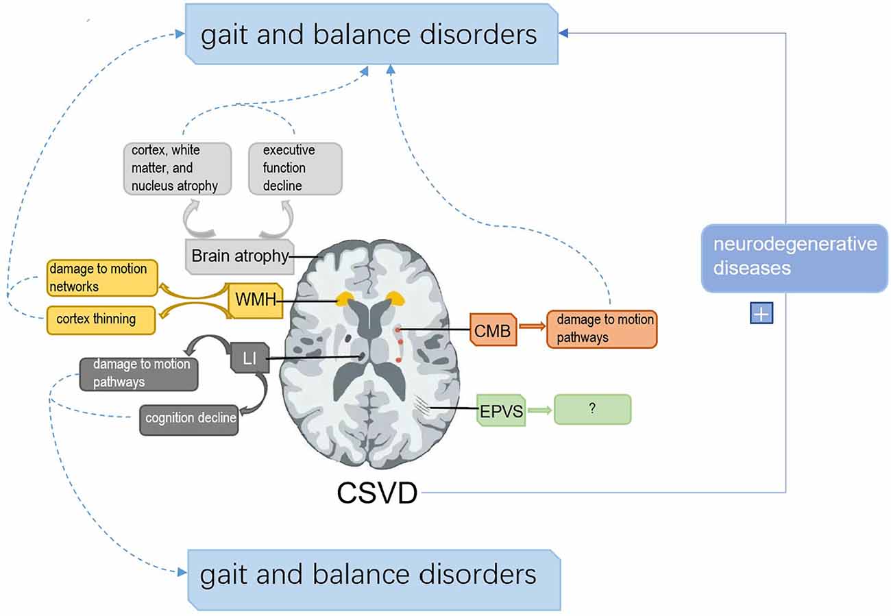 Frontiers  Fully Automatic Classification of Brain Atrophy on NCCT Images  in Cerebral Small Vessel Disease: A Pilot Study Using Deep Learning Models